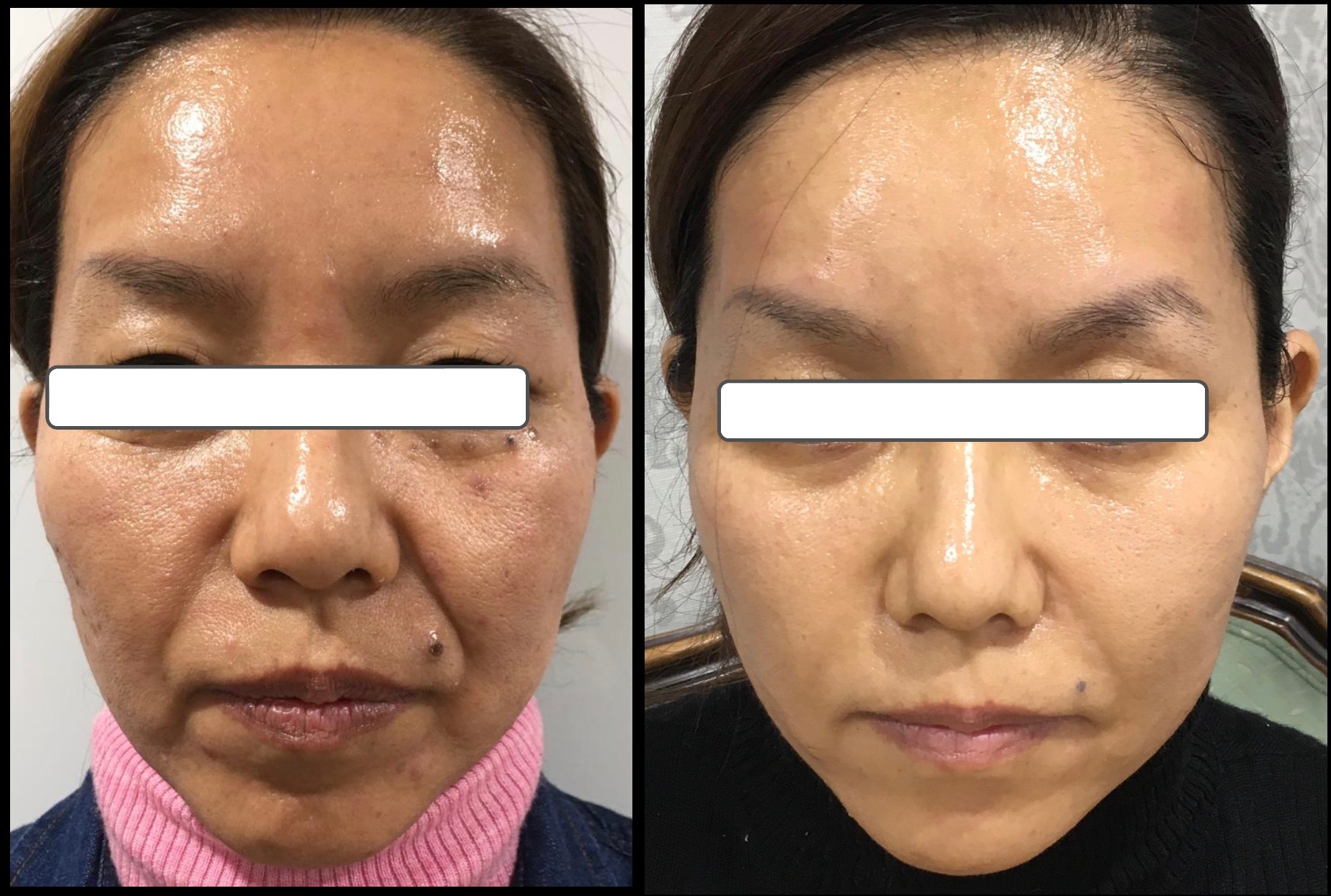 40代女性