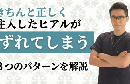 ヒアルロン酸は押すと移動しちゃうの？きちんと正しく注入したヒアルがずれてしまう３つのパターンを解説します