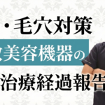 最新フォト＆フラクショナルレーザーの痛みとダウンタイムのリアルな経過